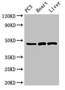 Western Blot. Positive WB detected in: PC-3 whole cell lysate, Rat heart tissue, Rat liver tissue. All lanes: ARRB2 antibody at 3.5µg/ml. Secondary. Goat polyclonal to rabbit IgG at 1/50000 dilution. Predicted band size: 47, 48, 46, 49, 45 kDa. Observed band size: 47 kDa