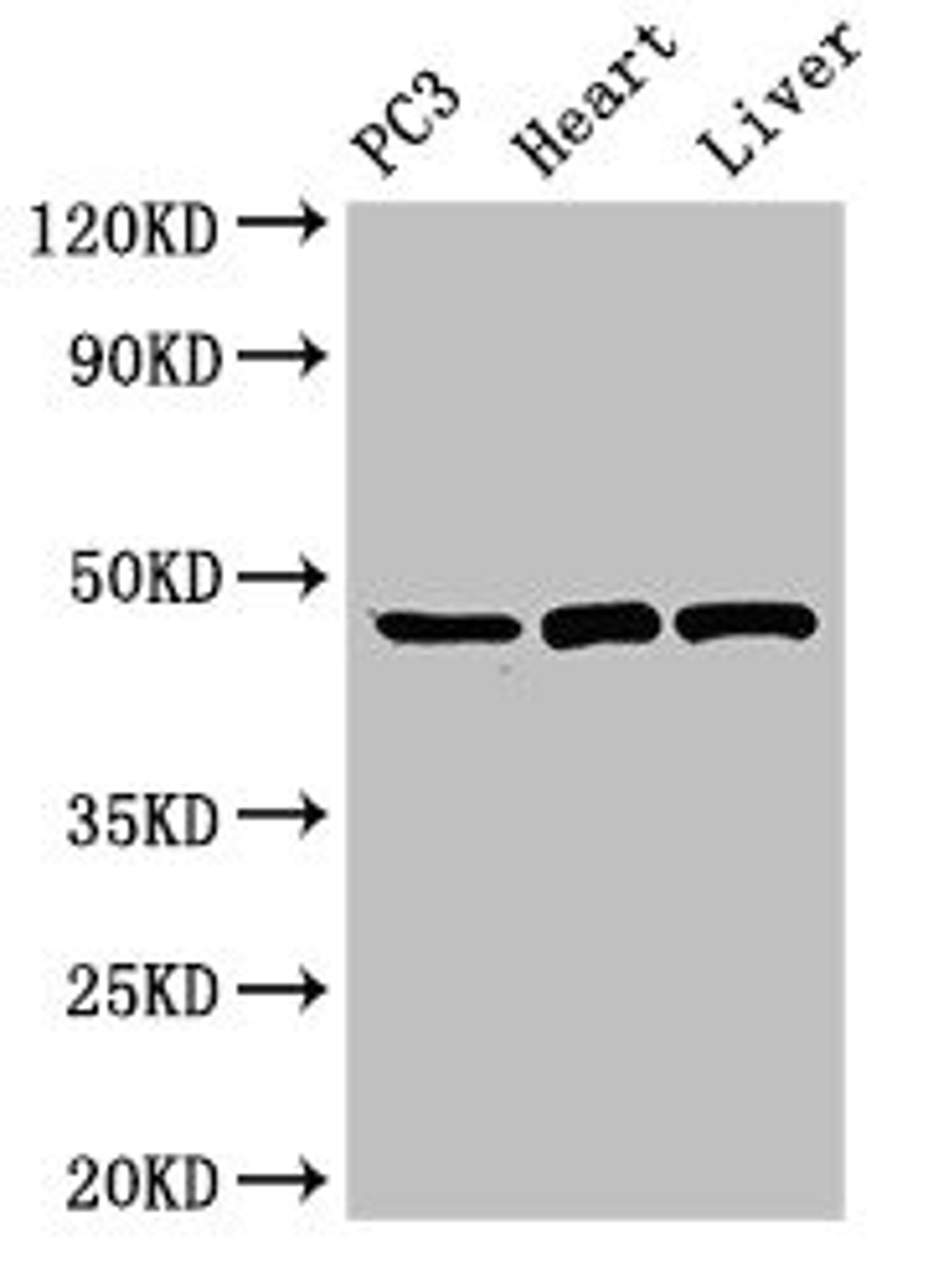 Western Blot. Positive WB detected in: PC-3 whole cell lysate, Rat heart tissue, Rat liver tissue. All lanes: ARRB2 antibody at 3.5µg/ml. Secondary. Goat polyclonal to rabbit IgG at 1/50000 dilution. Predicted band size: 47, 48, 46, 49, 45 kDa. Observed band size: 47 kDa