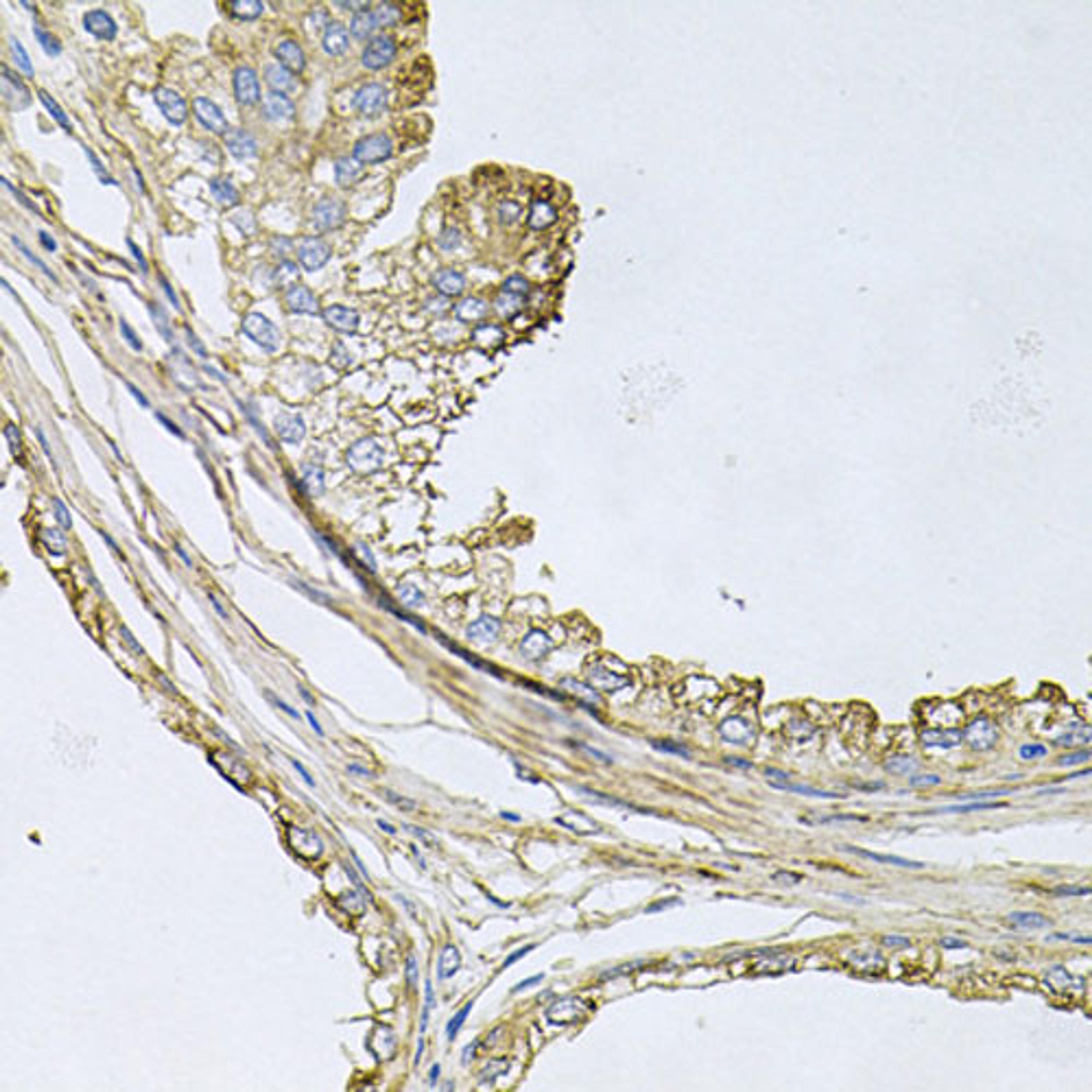 Immunohistochemistry  - ApoE antibody (A12400)