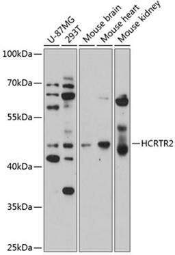 Western blot - HCRTR2 antibody (A3057)