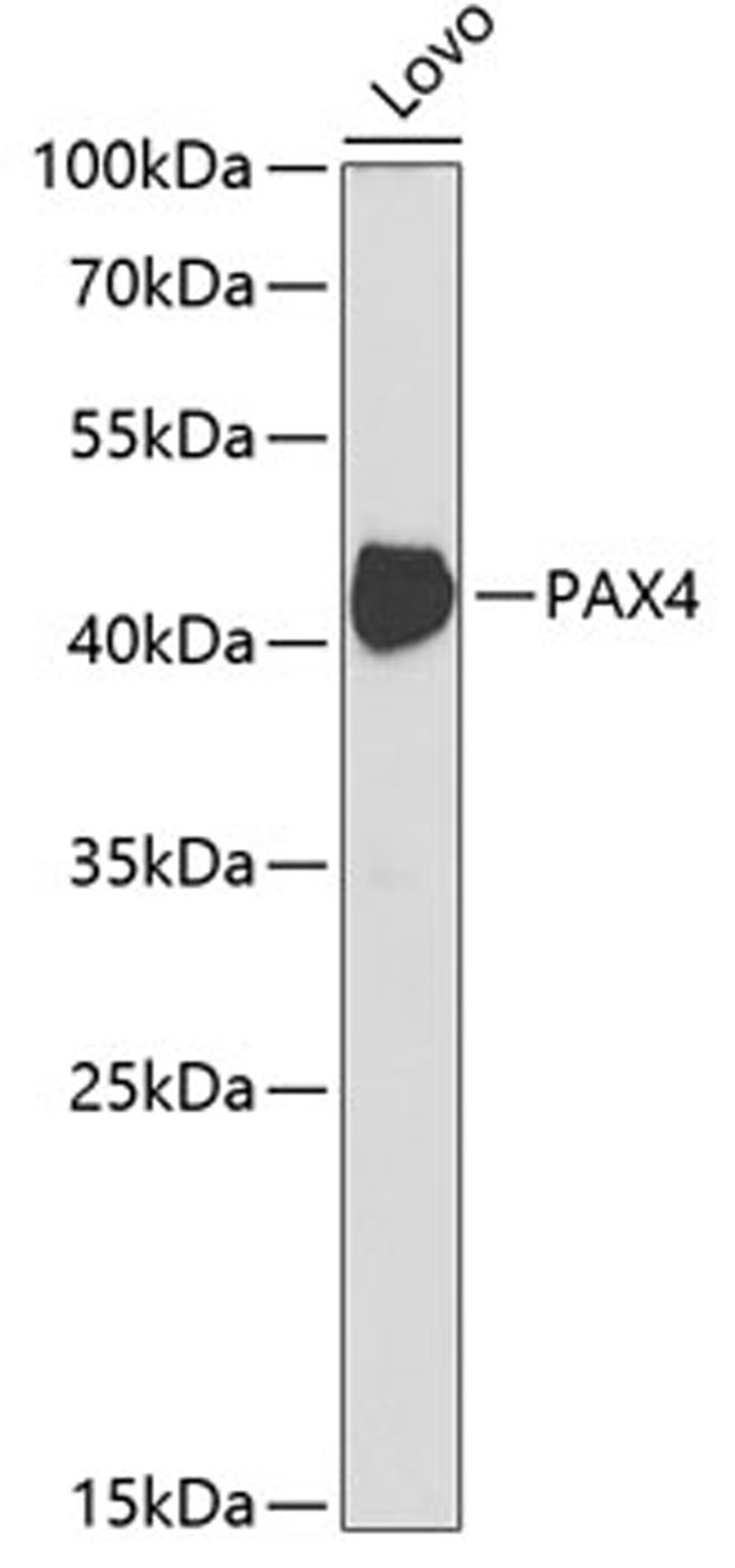 Western blot - PAX4 antibody (A5414)