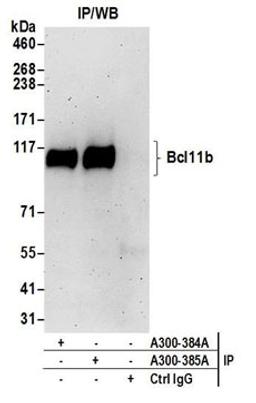 Detection of human Bcl11b by western blot of immunoprecipitates.