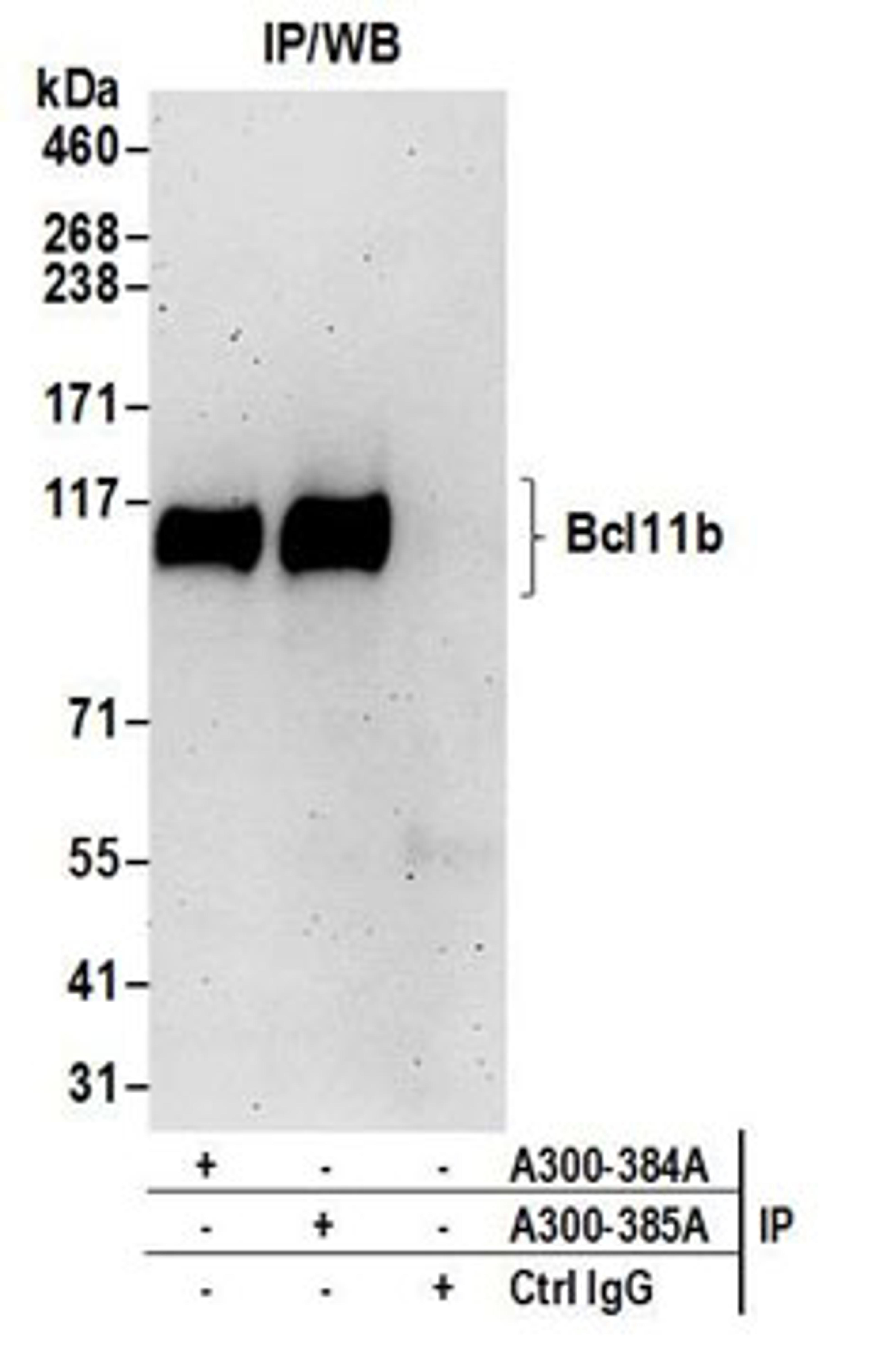 Detection of human Bcl11b by western blot of immunoprecipitates.