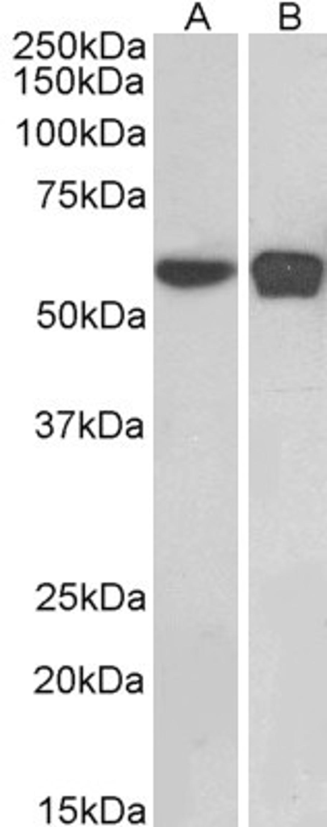 46-203 (0.1ug/ml) staining of HEK293 (A) and NIH3T3 (B) nuclear cell lysates (35ug protein in RIPA buffer). Primary incubation was 1 hour. Detected by chemiluminescence.