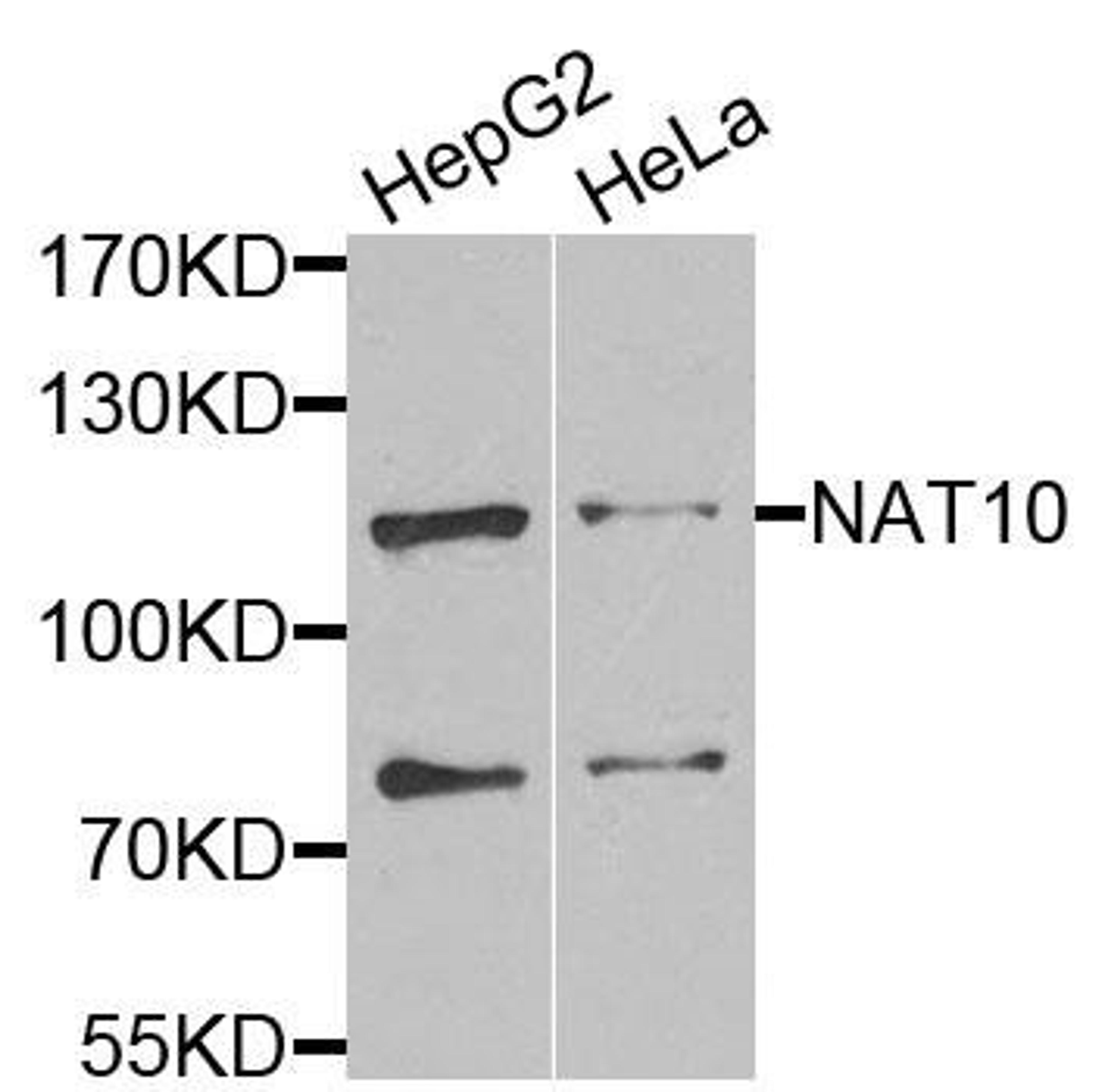 Western blot analysis of extracts of various cells using NAT10 antibody