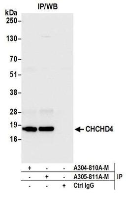 Detection of human CHCHD4 by WB of IP.