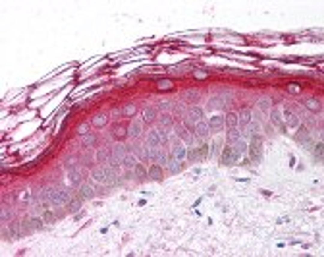 Immunohistochemistry staining of PDGFRA in skin tissue using PDGFRA Antibody.