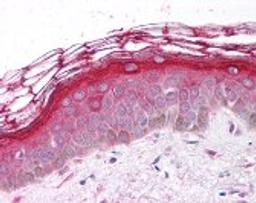 Immunohistochemistry staining of PDGFRA in skin tissue using PDGFRA Antibody.