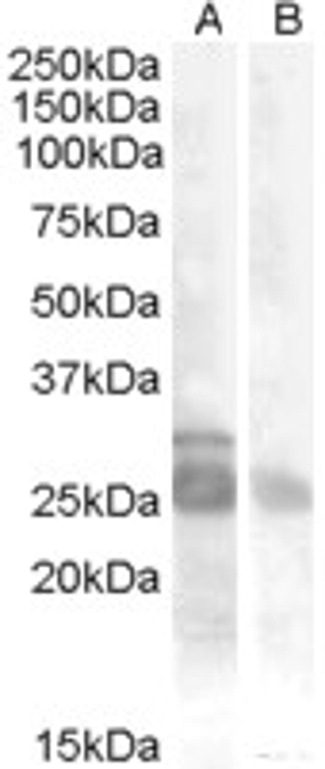 45-926 (0.5ug/ml) staining of Muscle lysate (35ug protein in RIPA buffer) with (B) and without (A) blocking with the immunising peptide. Primary incubation was 1 hour. Detected by chemiluminescence.