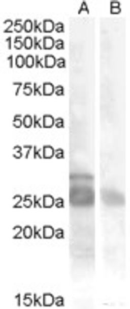 45-926 (0.5ug/ml) staining of Muscle lysate (35ug protein in RIPA buffer) with (B) and without (A) blocking with the immunising peptide. Primary incubation was 1 hour. Detected by chemiluminescence.