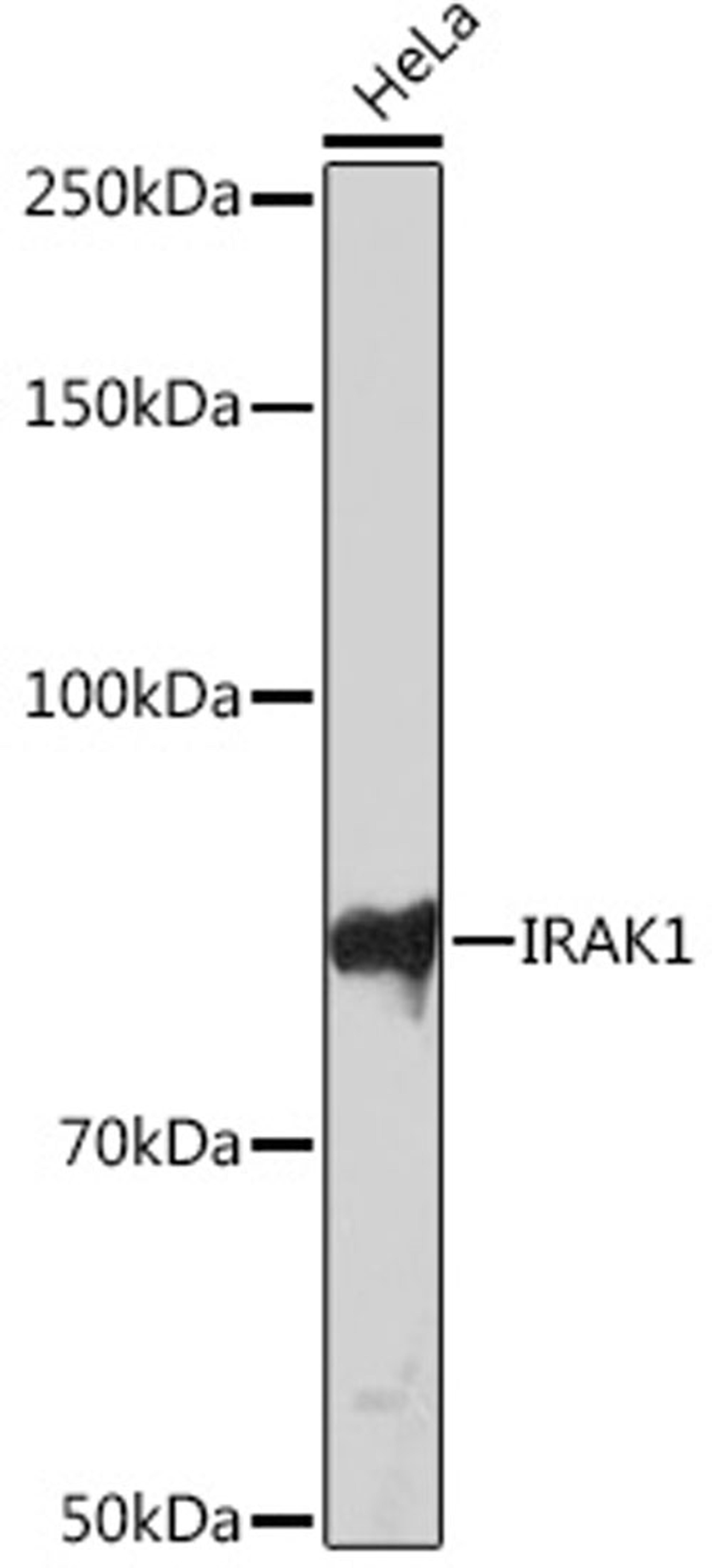 Western blot - IRAK1 Rabbit mAb (A4439)