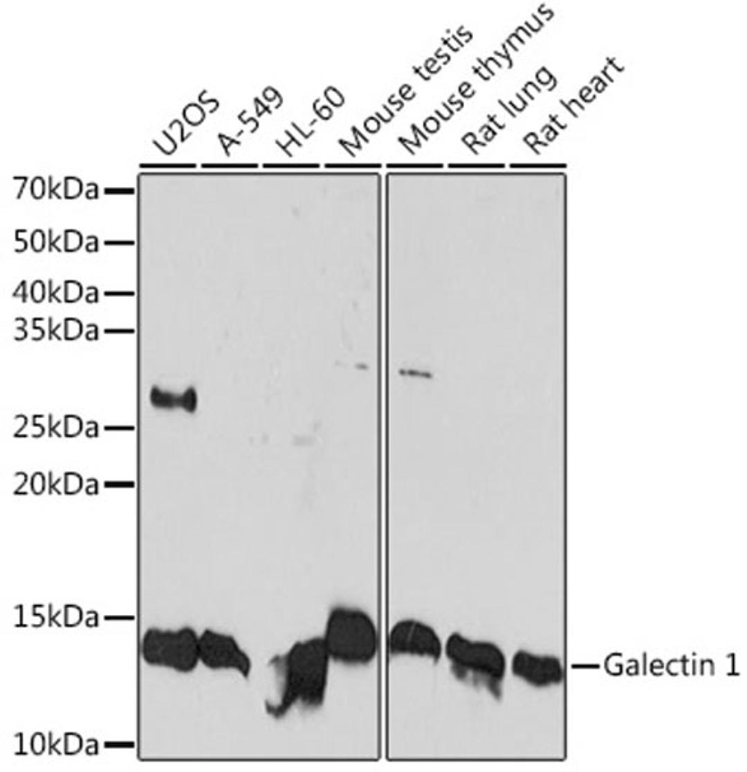 Western blot - Galectin 1 Rabbit mAb (A4732)