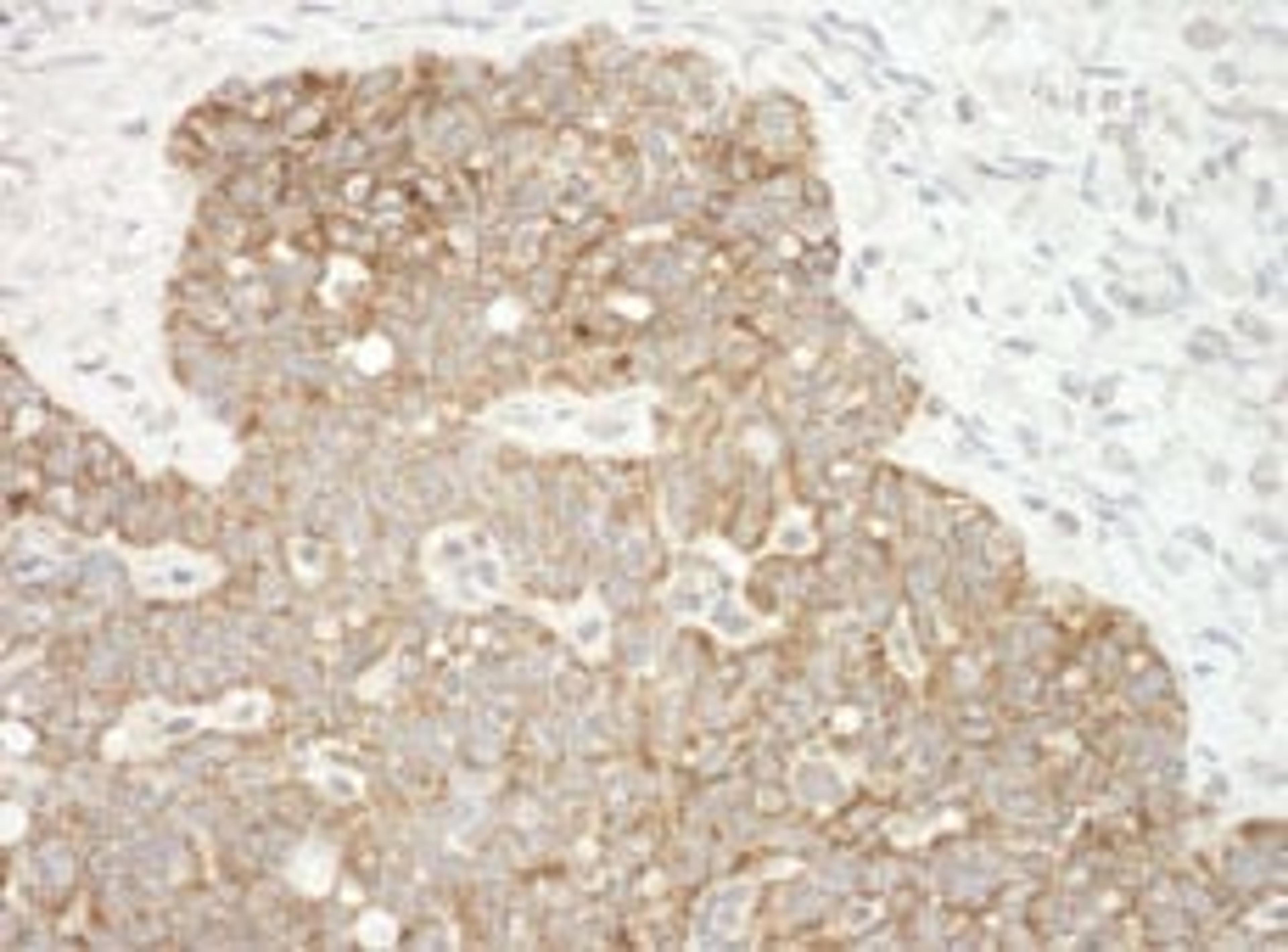 Detection of human AIF by immunohistochemistry.