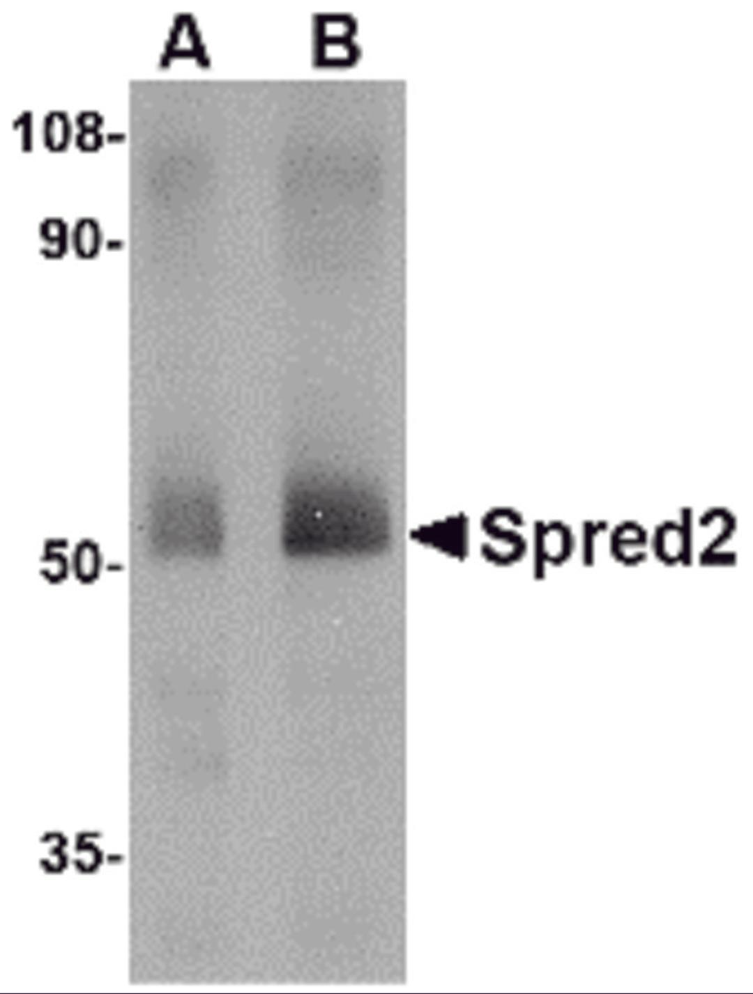 Western blot analysis of Spred2 in human small intestine tissue lysate with Spred2 antibody at (A) 1 and (B) 2 μg/mL.
