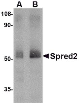 Western blot analysis of Spred2 in human small intestine tissue lysate with Spred2 antibody at (A) 1 and (B) 2 μg/mL.