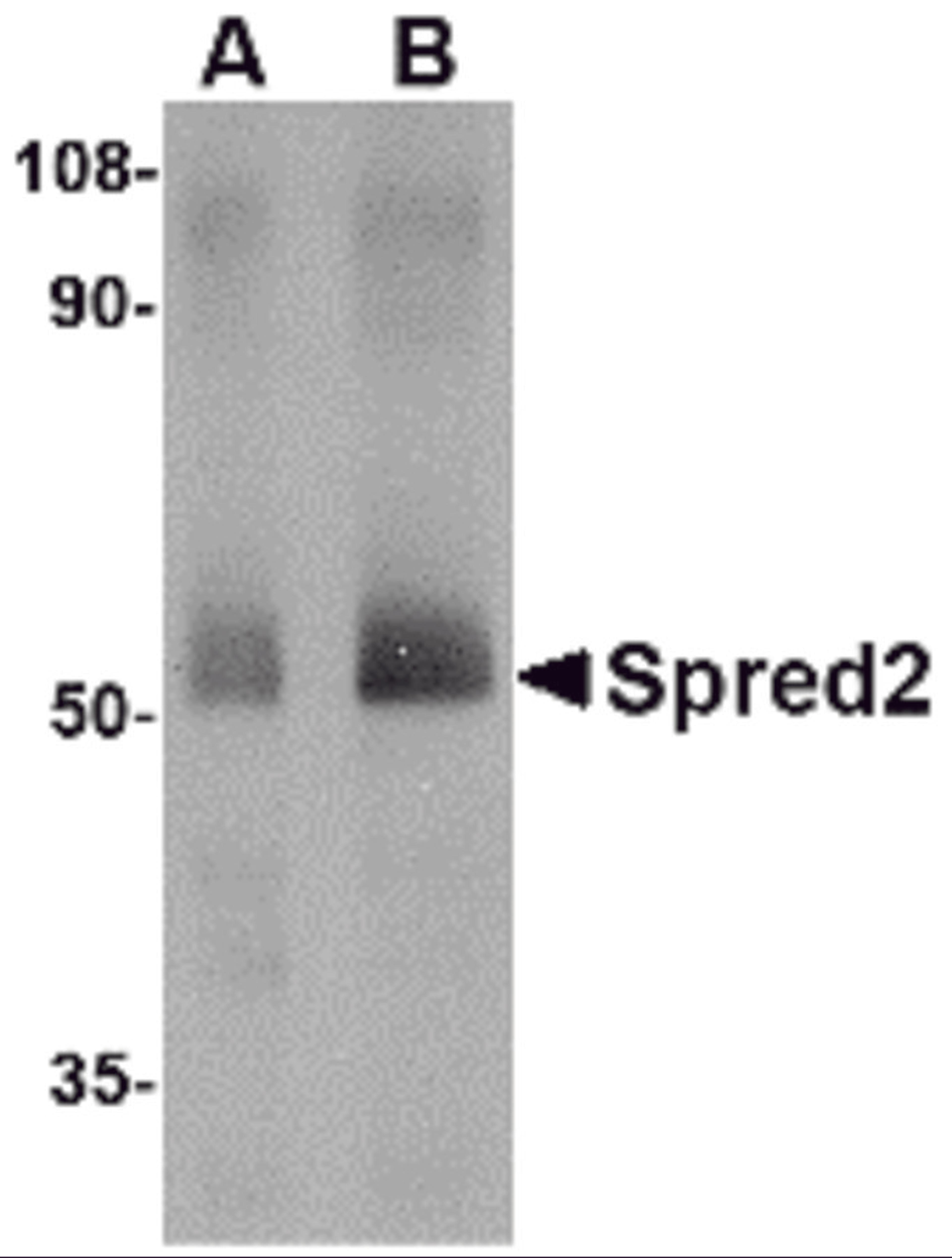Western blot analysis of Spred2 in human small intestine tissue lysate with Spred2 antibody at (A) 1 and (B) 2 μg/mL.
