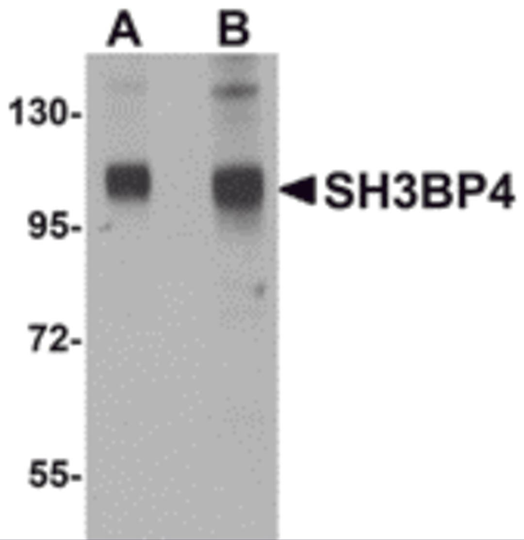 Western blot analysis of SH3BP4 in rat lung tissue lysate with SH3BP4 antibody at (A) 1 and (B) 2 μg/mL.