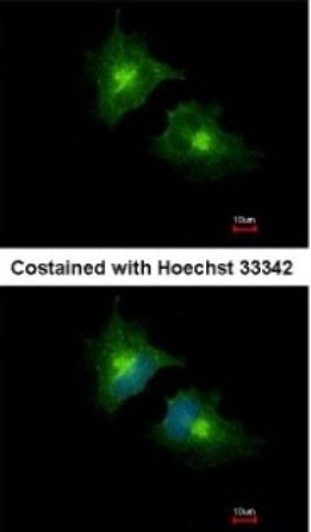 Immunocytochemistry/Immunofluorescence: SCAMP3 Antibody [NBP1-32099] - Analysis of methanol-fixed HeLa, using SCAMP3 antibody at 1:1000 dilution.