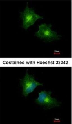 Immunocytochemistry/Immunofluorescence: SCAMP3 Antibody [NBP1-32099] - Analysis of methanol-fixed HeLa, using SCAMP3 antibody at 1:1000 dilution.