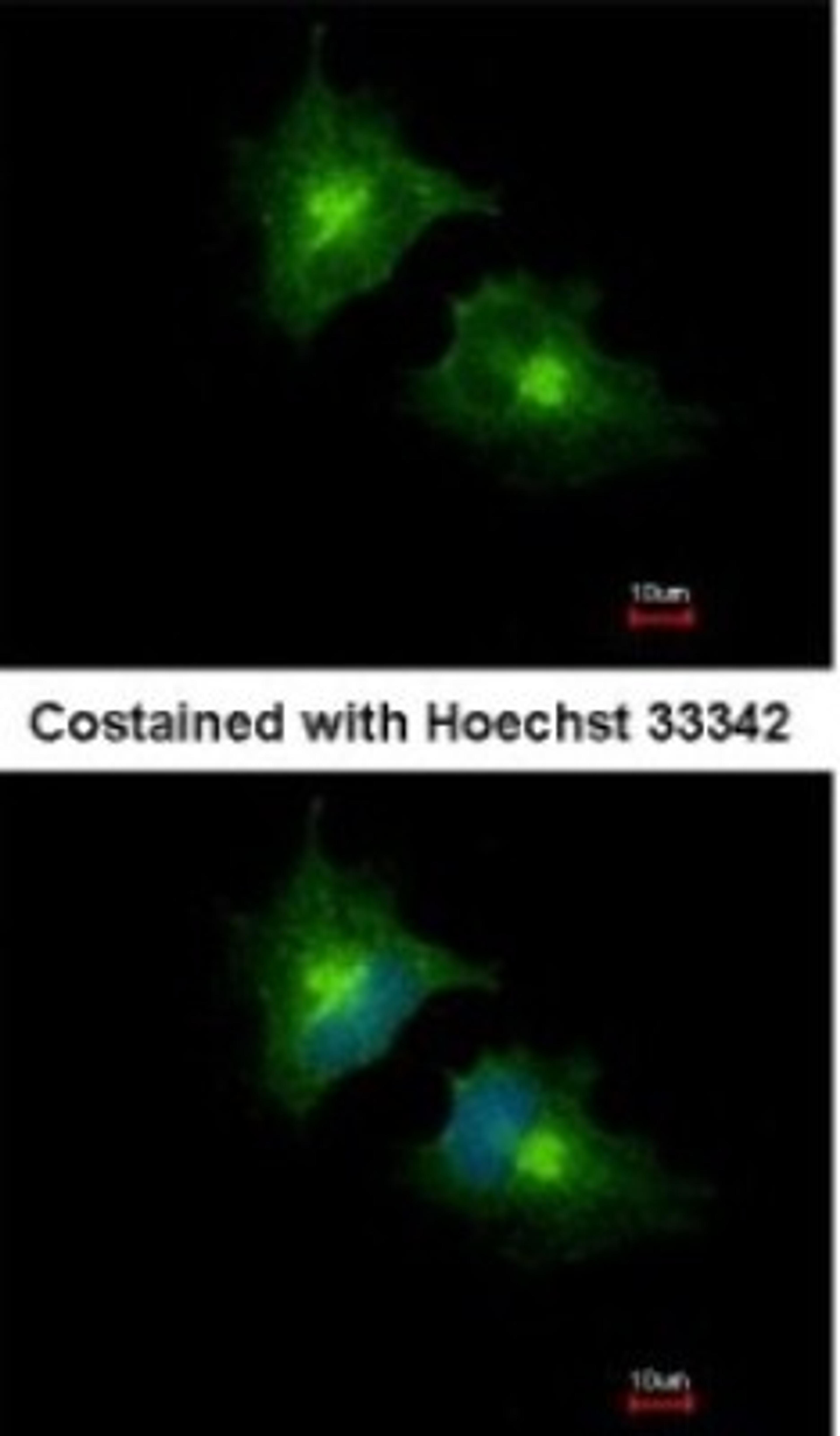 Immunocytochemistry/Immunofluorescence: SCAMP3 Antibody [NBP1-32099] - Analysis of methanol-fixed HeLa, using SCAMP3 antibody at 1:1000 dilution.