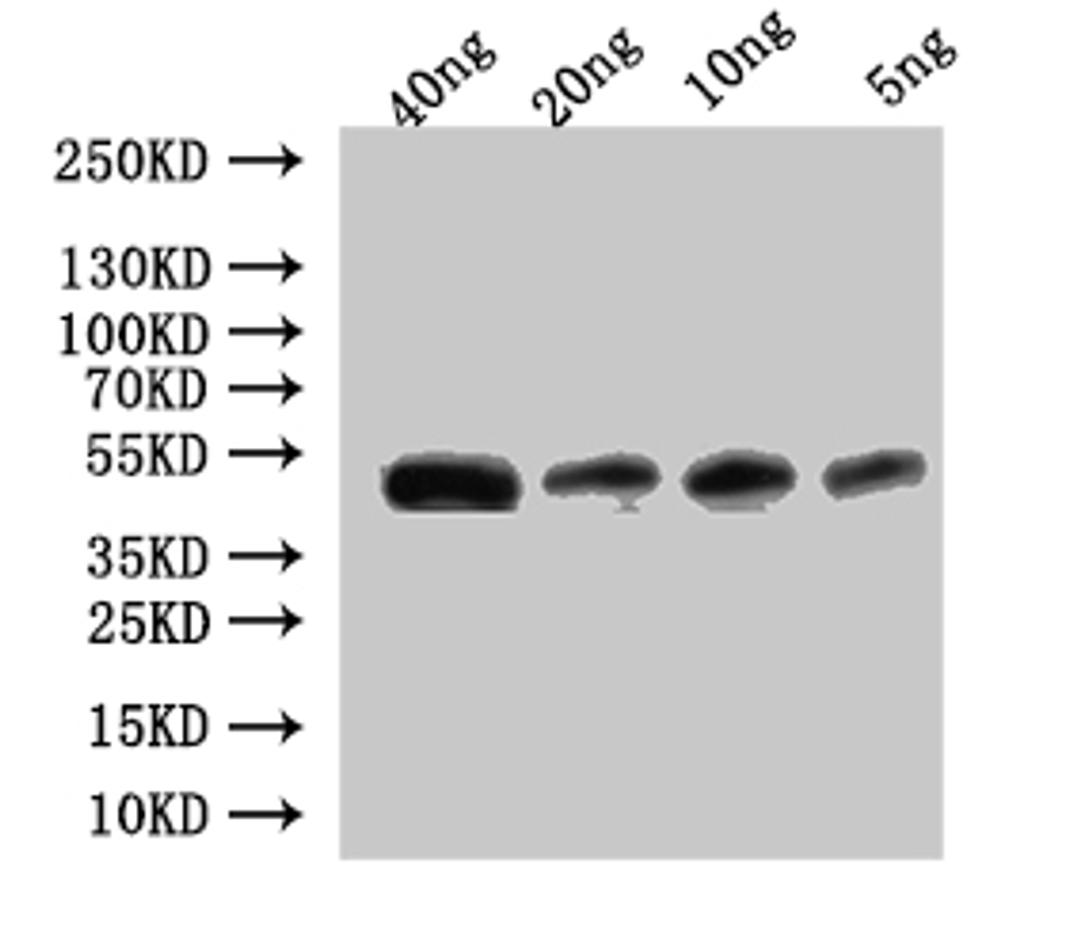 Western Blot. Positive WB detected in: recombinant protein. All lanes:Ctl2 Antibody at 1:1000. Secondary. Goat polyclonal to rabbit IgG at 1/50000 dilution. Predicted band size: 43.5 kDa. Observed band size: 45 kDa.