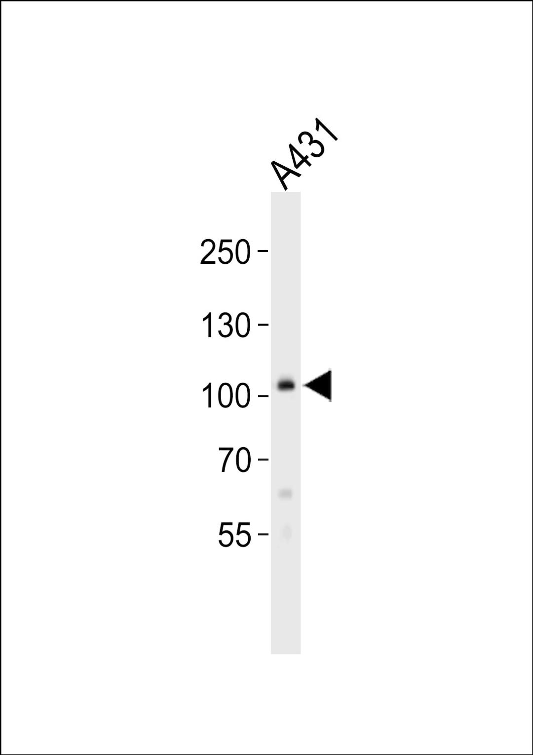 Western blot analysis of lysate from A431 cell line, using COL6A1 Antibody at 1:1000.