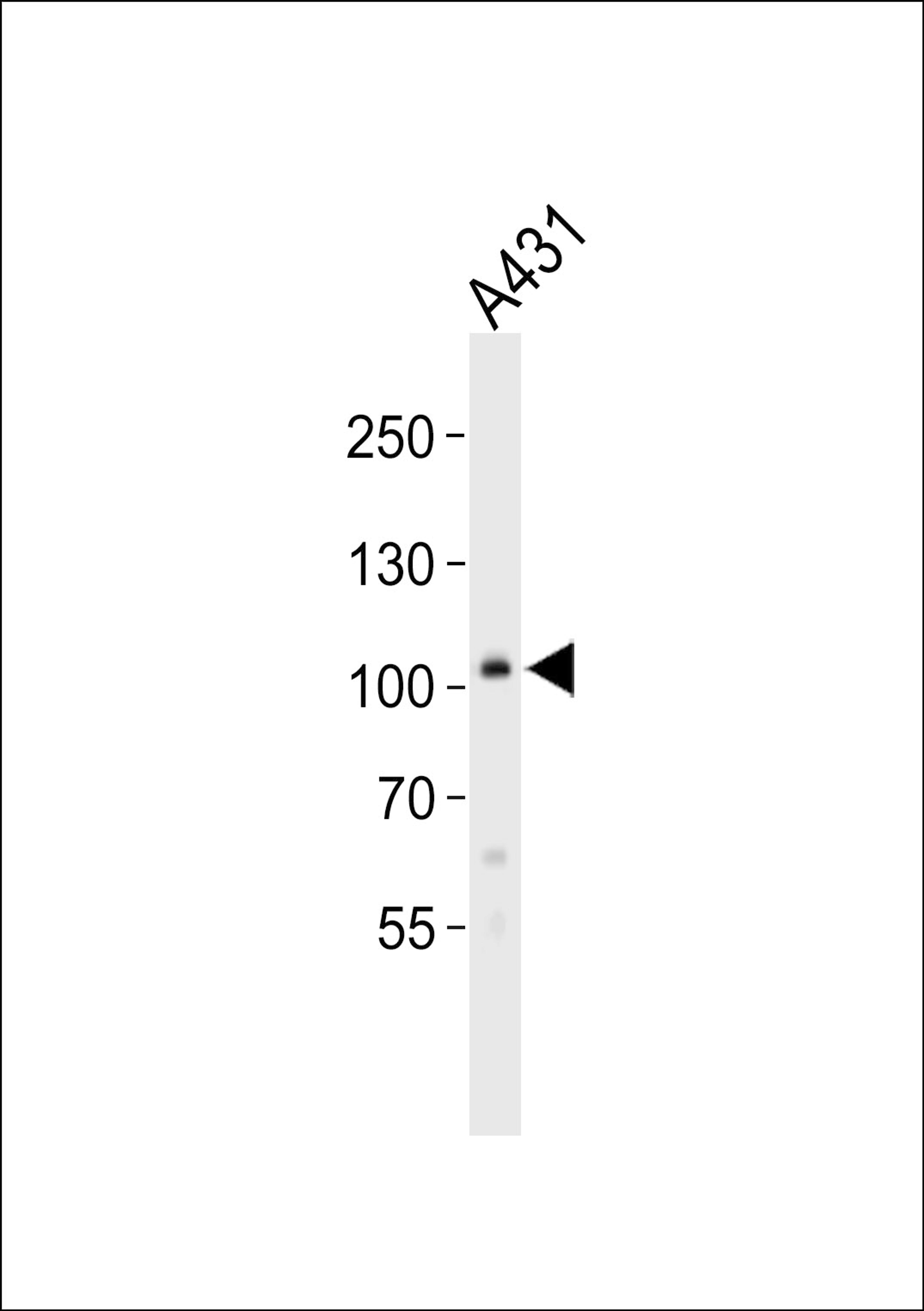 Western blot analysis of lysate from A431 cell line, using COL6A1 Antibody at 1:1000.