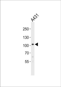 Western blot analysis of lysate from A431 cell line, using COL6A1 Antibody at 1:1000.