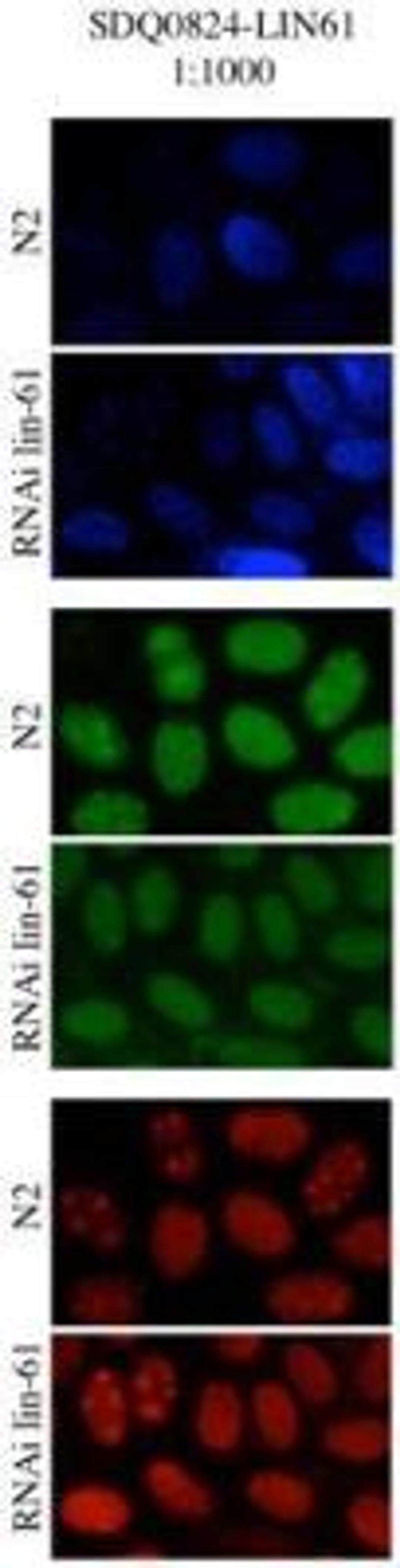 Immunocytochemistry/Immunofluorescence: LIN-61 Antibody [29590002] - Staining of LIN 61 antibody at a dilution of 1:1,000. Image courtesy of University of Cambridge, Ahringer Lab.