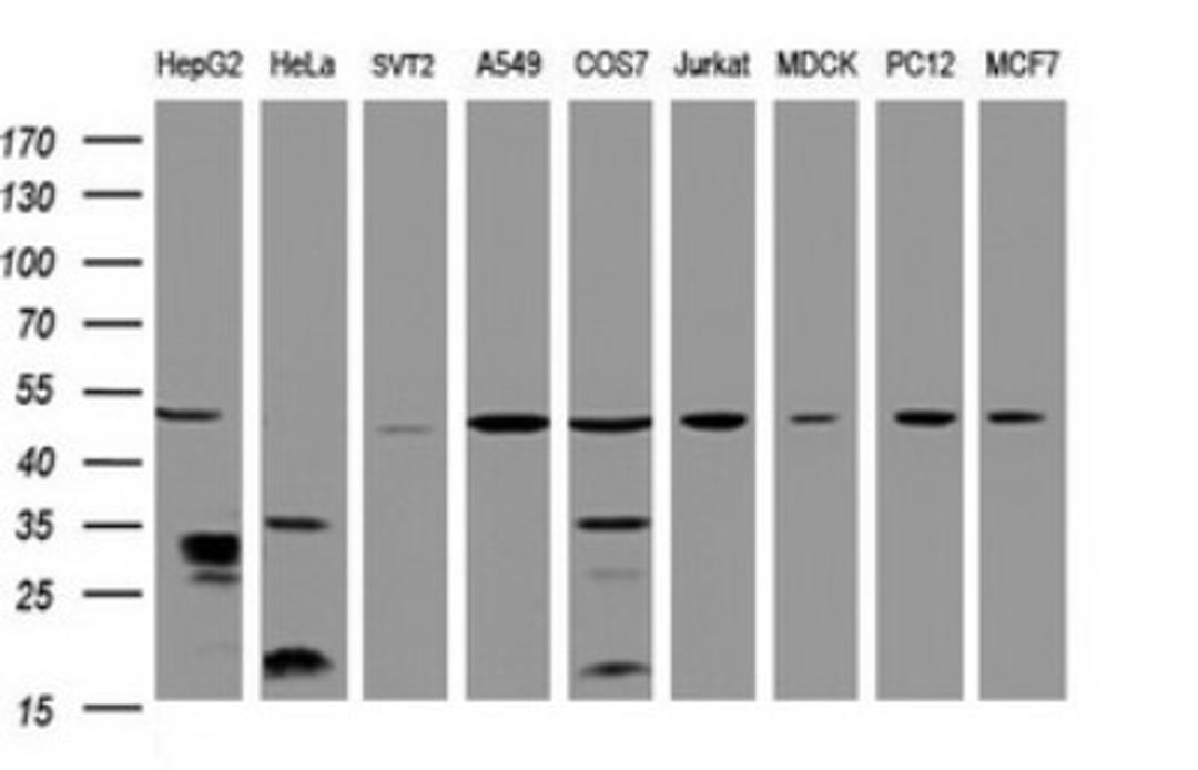 Western Blot: TBC1D13 Antibody (2C5) [NBP2-45985] - Analysis of extracts (35ug) from 9 different cell lines by using TBC1D13 monoclonal antibody (HepG2: human; HeLa: human; SVT2: mouse; A549: human; COS7: monkey; Jurkat: human; MDCK: canine; PC12: rat; MCF7: human). Dilution: 1:2000