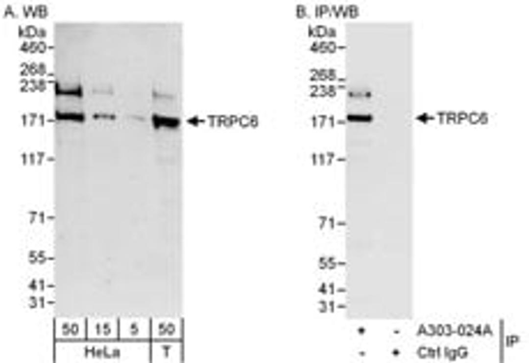 Detection of human TRPC6 by western blot and immunoprecipitation.