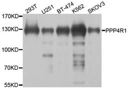 Western blot analysis of extracts of various cell lines using PPP4R1 antibody