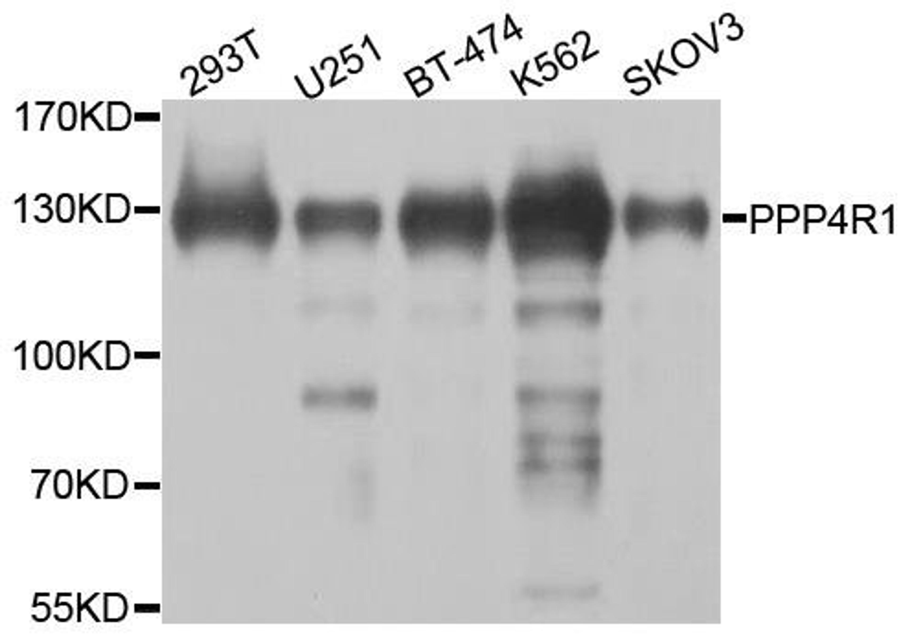 Western blot analysis of extracts of various cell lines using PPP4R1 antibody