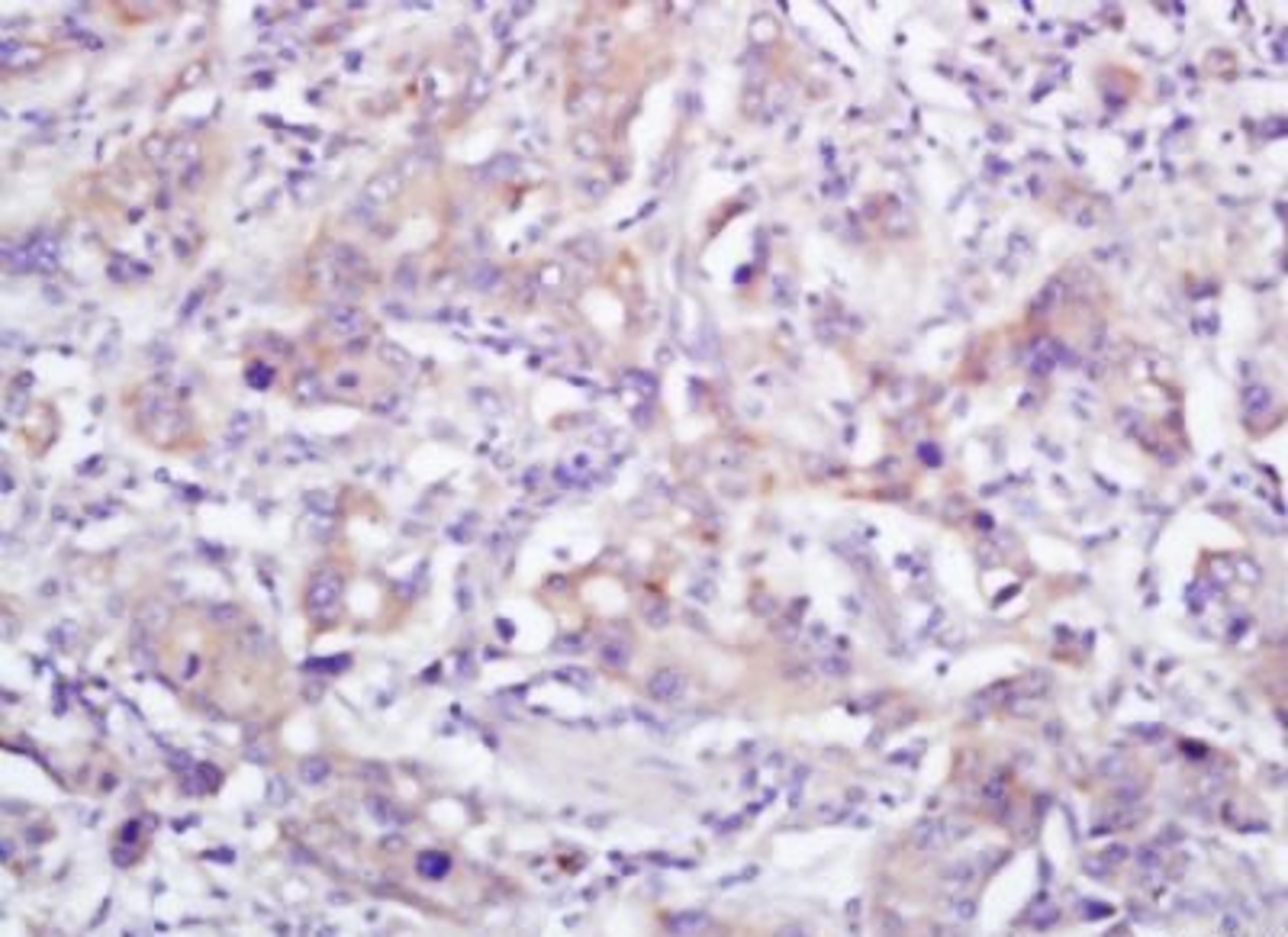 Immunohistochemical analysis of formalin-fixed paraffin embedded mouse intestine tissue using E Cadherin antibody (dilution at 1:200)