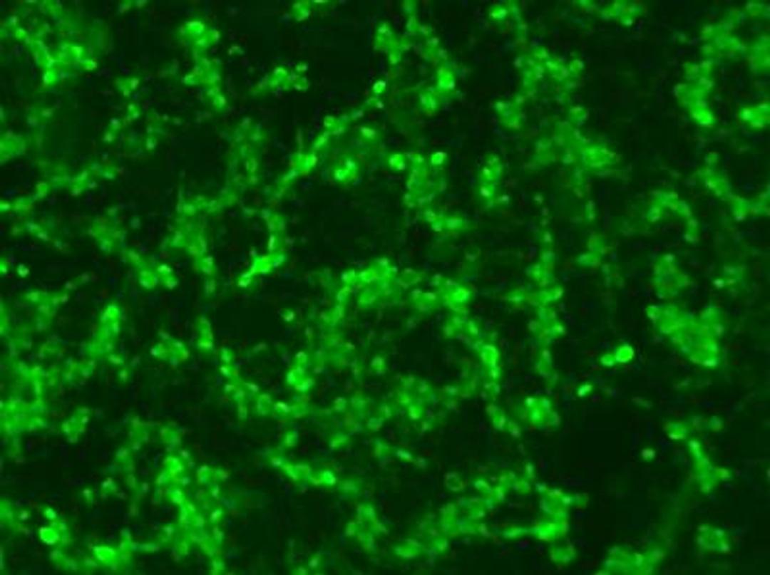 Immunocytochemistry/Immunofluorescence: RPE65 Antibody (401.8B11.3D9) [NB100-355] - ICC-IF analysis of cultured ARPE19 cells, a spontaneously arising human retinal pigment epithelia cell line - 10 minutes fixation in 4% PFA, 10 minutes permeabilization in PBS containing 0.2% Triton X-100 (PBS-T), 1 hour blocking in 10% normal goat serum containing 1% BSA in PBS-T, 1:100 primary antibody dilution in PBS, ON 4C incubation.