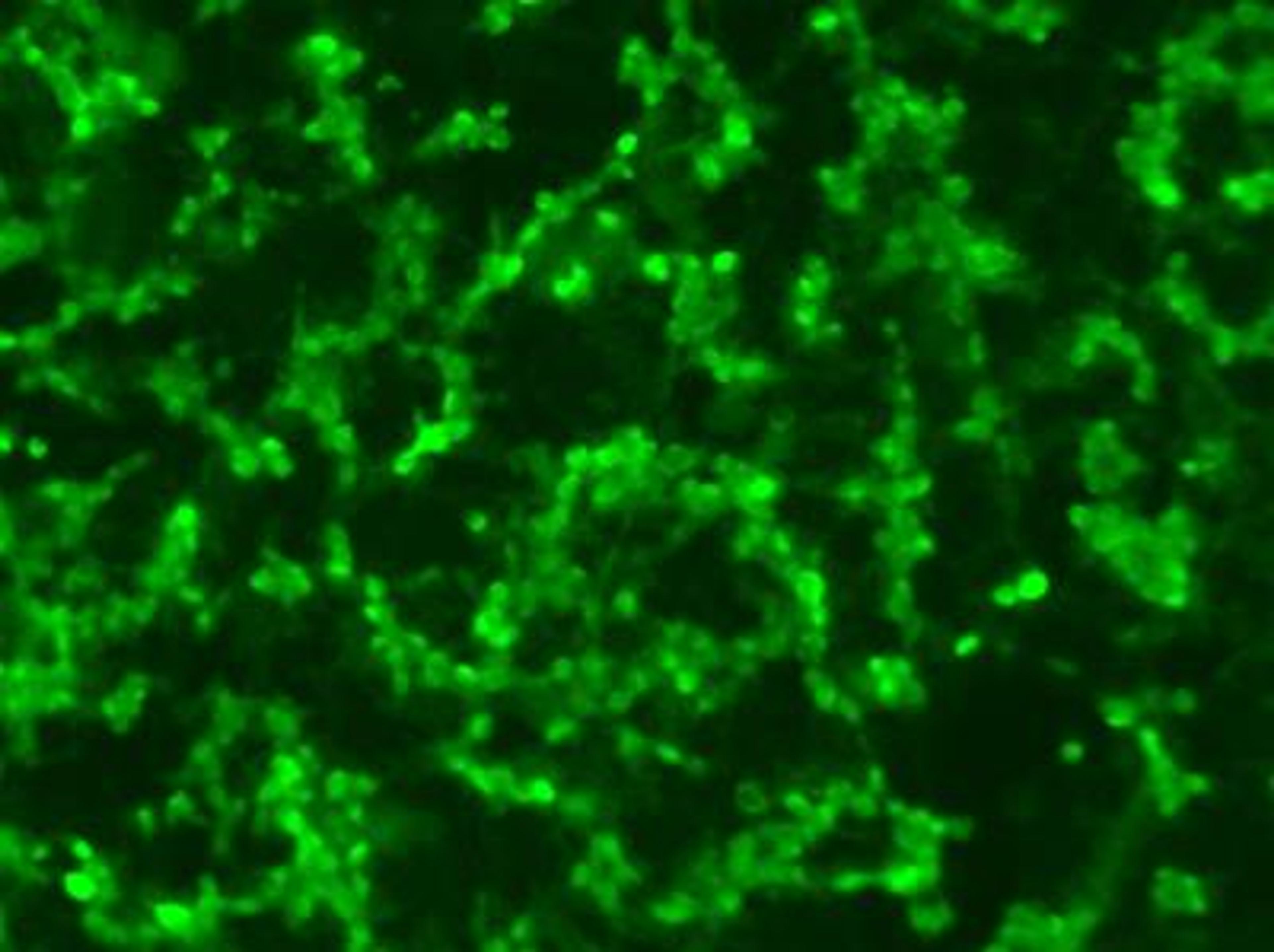 Immunocytochemistry/Immunofluorescence: RPE65 Antibody (401.8B11.3D9) [NB100-355] - ICC-IF analysis of cultured ARPE19 cells, a spontaneously arising human retinal pigment epithelia cell line - 10 minutes fixation in 4% PFA, 10 minutes permeabilization in PBS containing 0.2% Triton X-100 (PBS-T), 1 hour blocking in 10% normal goat serum containing 1% BSA in PBS-T, 1:100 primary antibody dilution in PBS, ON 4C incubation.