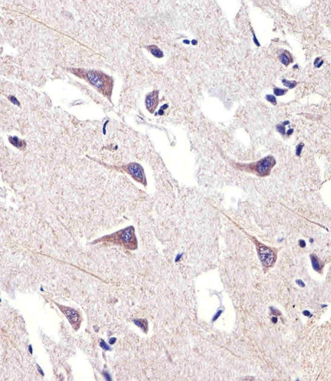 Immunohistochemical analysis of paraffin-embedded H.brain section using FADS2 Antibody . Antibody was diluted at 1:25 dilution. A peroxidase-conjugated goat anti-rabbit IgG at 1:400 dilution was used as the secondary antibody, followed by DAB staining.