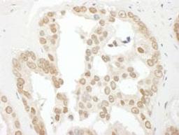 Detection of human BCCIP by immunohistochemistry.