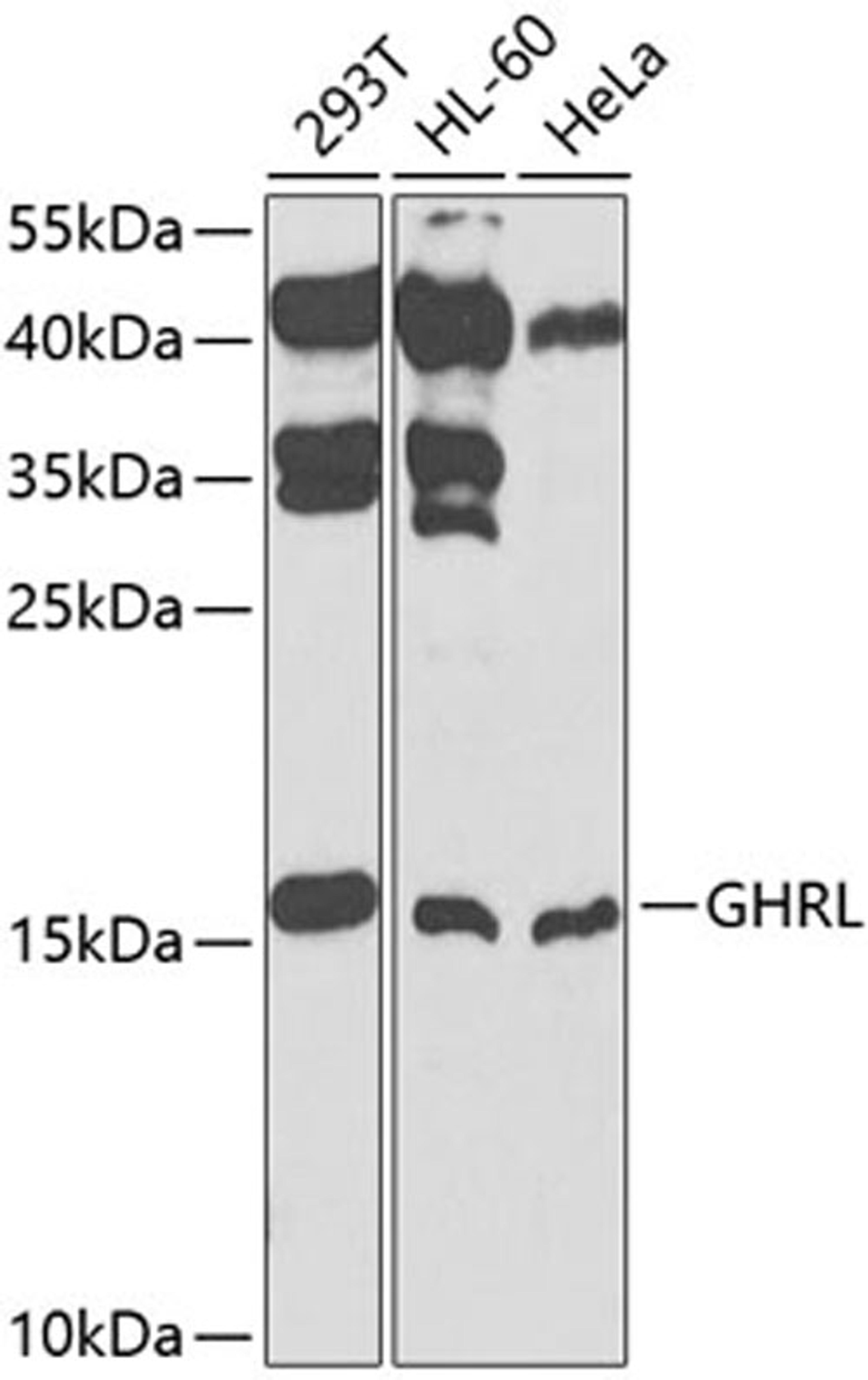 Western blot - GHRL antibody (A1338)