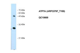 Antibody used in WB on Human HepG2 at 0.5 ug/ml.