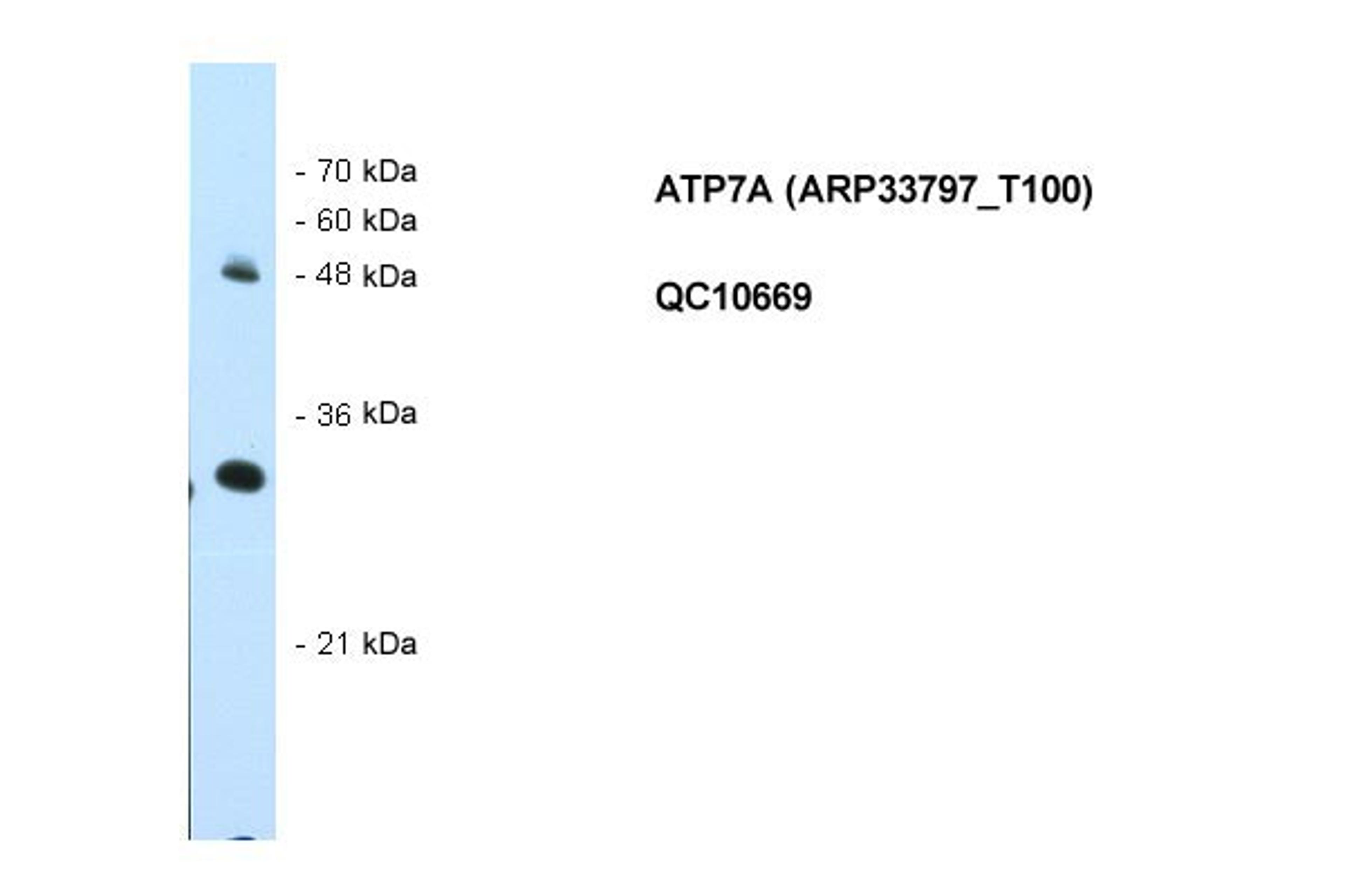 Antibody used in WB on Human HepG2 at 0.5 ug/ml.