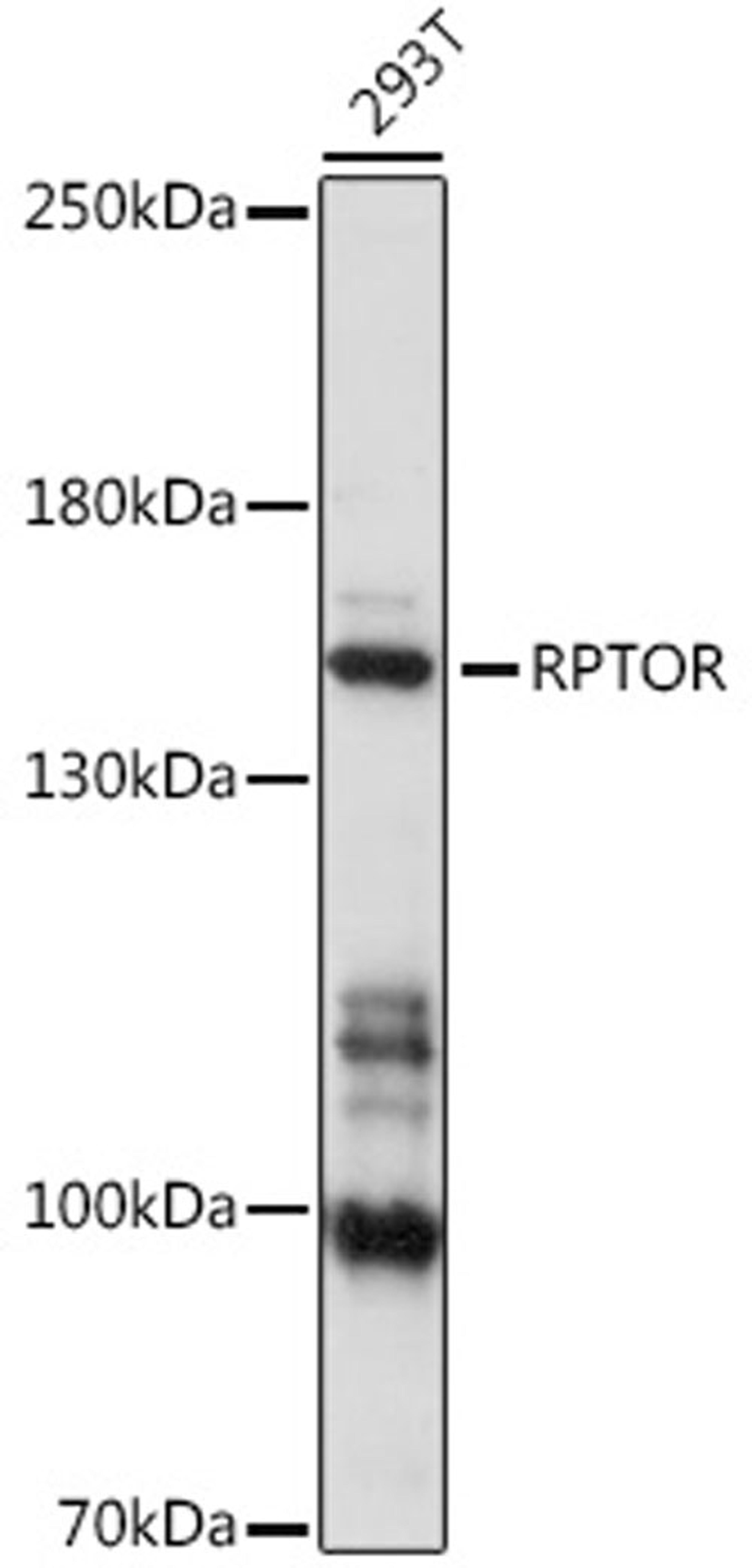 Western blot - RPTOR antibody (A16309)