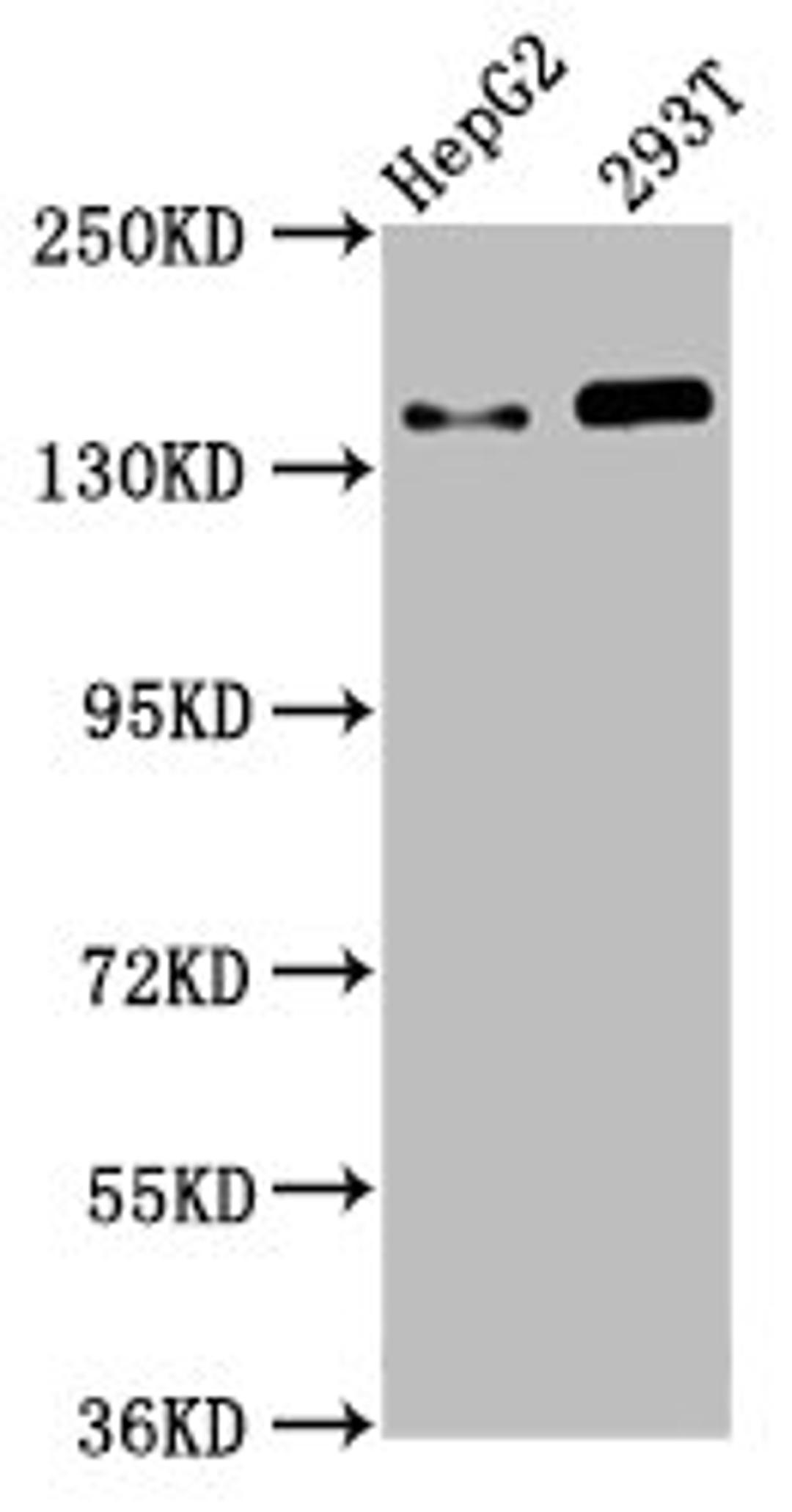 Western Blot. Positive WB detected in: HepG2 whole cell lysate, 293T whole cell lysate. All lanes: SMC5 antibody at 4.6µg/ml. Secondary. Goat polyclonal to rabbit IgG at 1/50000 dilution. Predicted band size: 129 kDa. Observed band size: 145 kDa