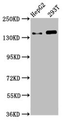 Western Blot. Positive WB detected in: HepG2 whole cell lysate, 293T whole cell lysate. All lanes: SMC5 antibody at 4.6µg/ml. Secondary. Goat polyclonal to rabbit IgG at 1/50000 dilution. Predicted band size: 129 kDa. Observed band size: 145 kDa