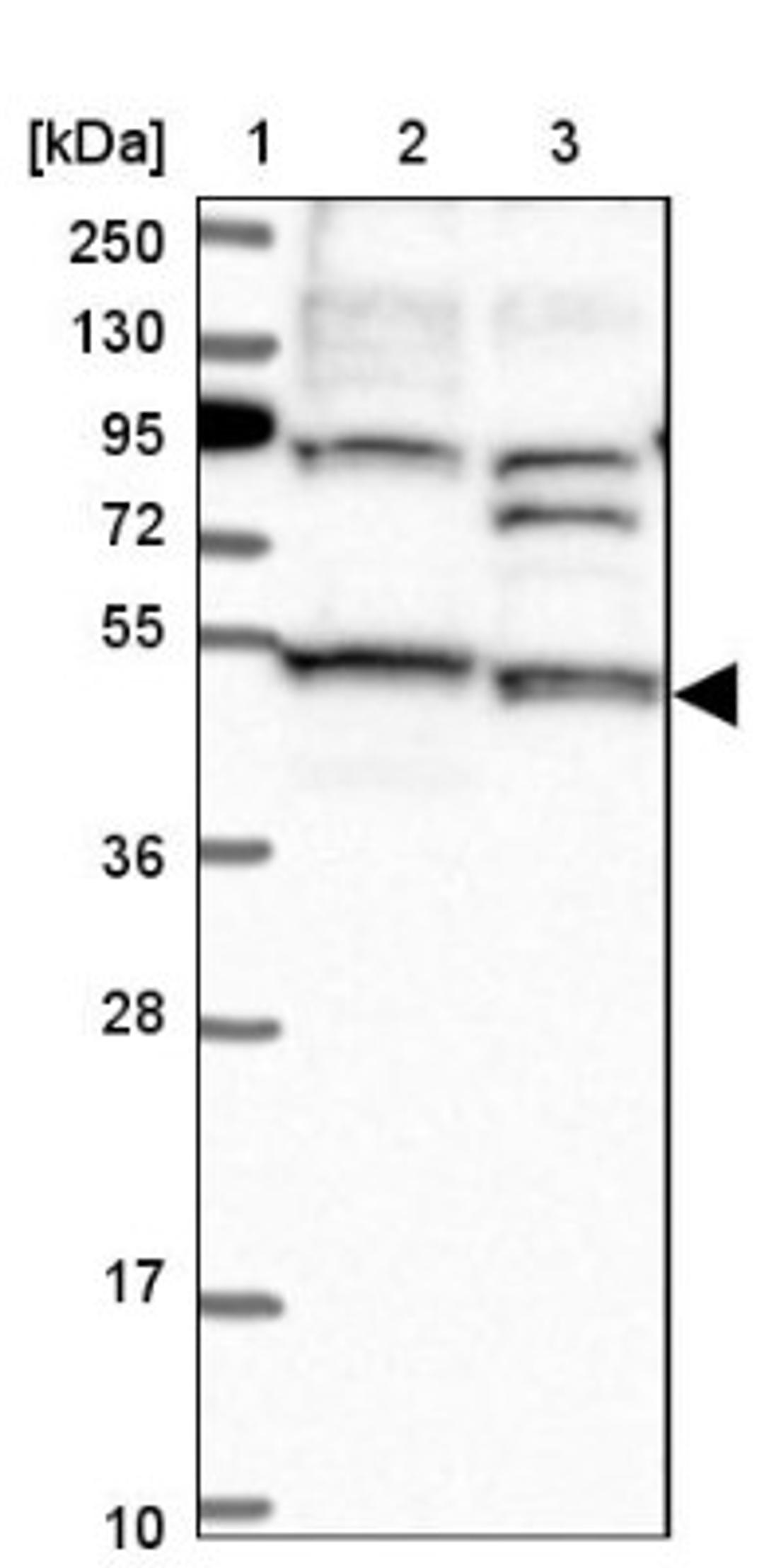 Western Blot: STAMBPL1 Antibody [NBP1-89135] - Lane 1: Marker [kDa] 250, 130, 95, 72, 55, 36, 28, 17, 10<br/>Lane 2: Human cell line RT-4<br/>Lane 3: Human cell line U-251MG sp