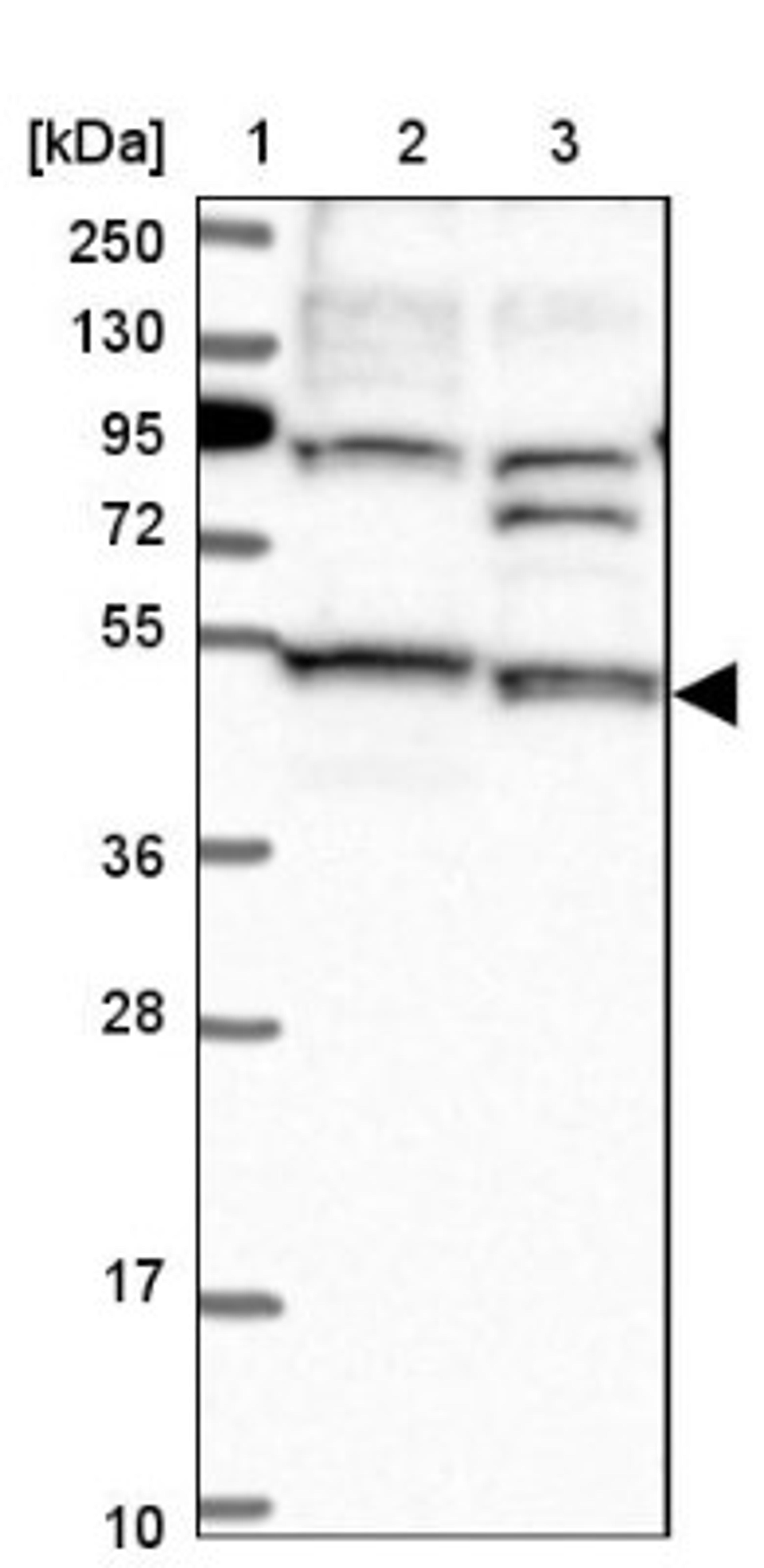 Western Blot: STAMBPL1 Antibody [NBP1-89135] - Lane 1: Marker [kDa] 250, 130, 95, 72, 55, 36, 28, 17, 10<br/>Lane 2: Human cell line RT-4<br/>Lane 3: Human cell line U-251MG sp