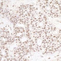 Detection of human ERCC3 by immunohistochemistry.