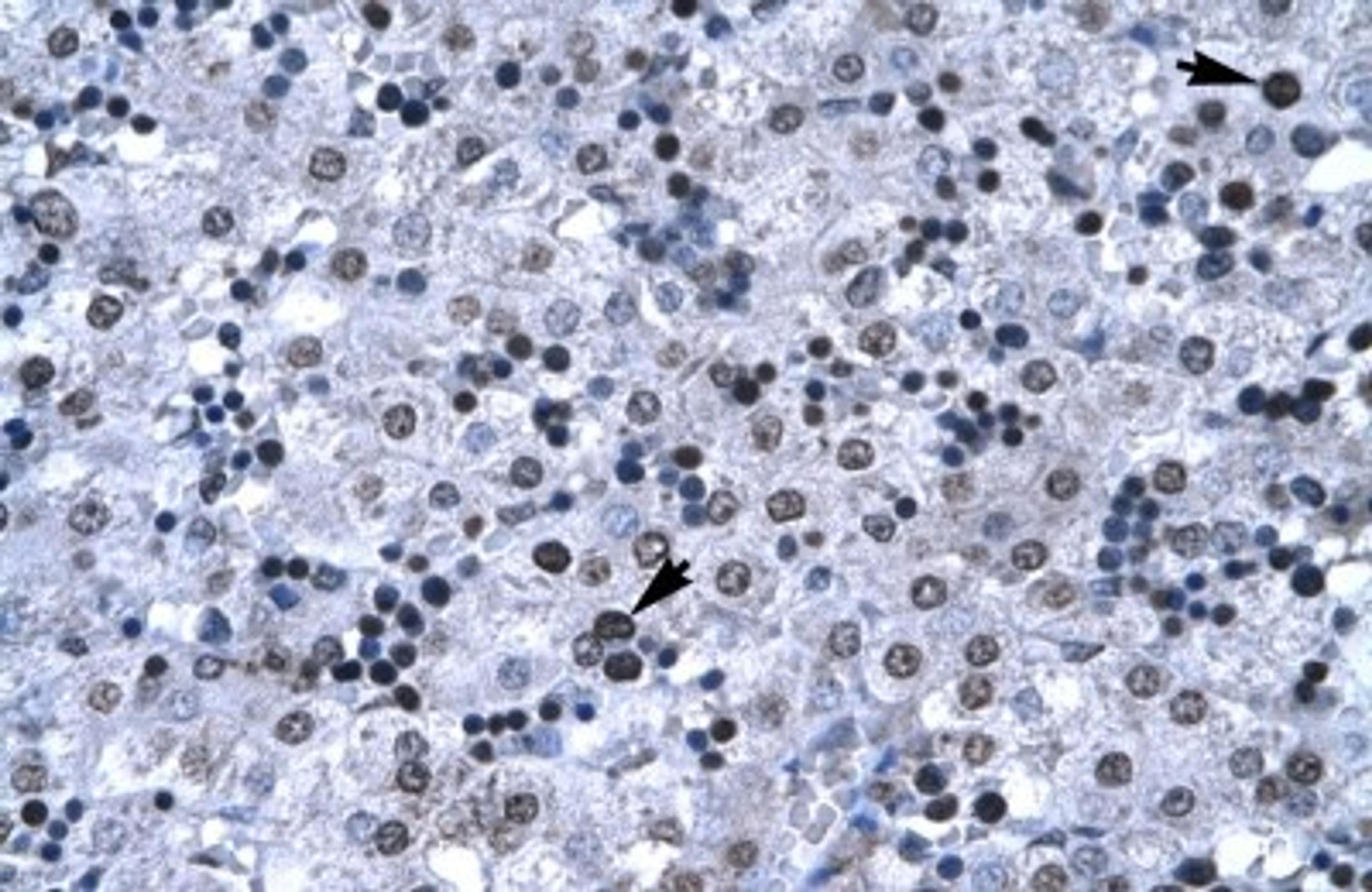 Immunohistochemistry-Paraffin: FOXG1A/FOXG1B Antibody [NBP1-56594] - Human Liver Tissue, antibody concentration 4-8ug/ml. Cells with positive label: Hepatocytes (indicated with arrows) 400X magnification.