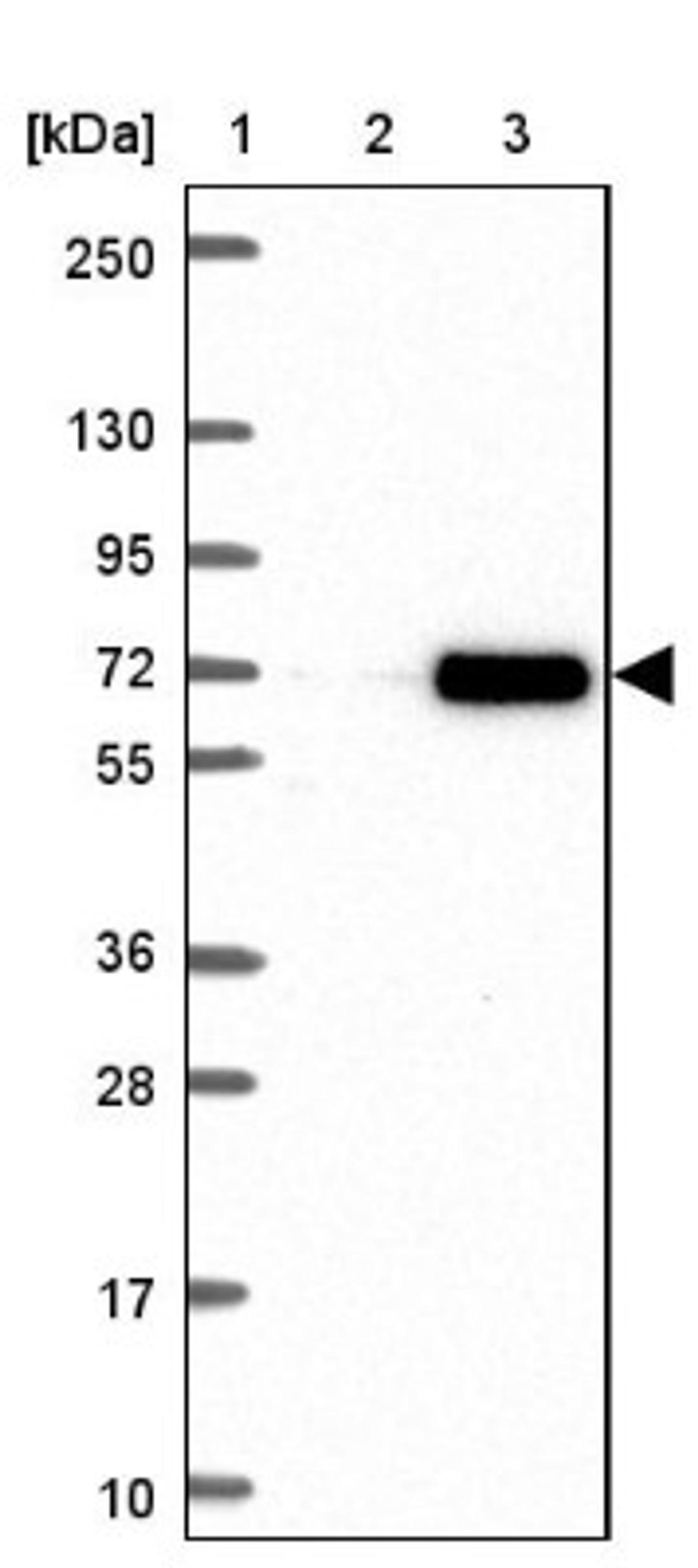 Western Blot: RNF6 Antibody [NBP2-38445] - Lane 1: Marker [kDa] 250, 130, 95, 72, 55, 36, 28, 17, 10<br/>Lane 2: Negative Control<br/>Lane 3: LY416958