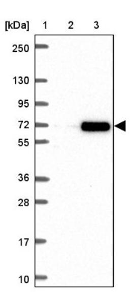 Western Blot: RNF6 Antibody [NBP2-38445] - Lane 1: Marker [kDa] 250, 130, 95, 72, 55, 36, 28, 17, 10<br/>Lane 2: Negative Control<br/>Lane 3: LY416958